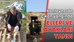 Çıkan yangında elleri ve ayakları yandı